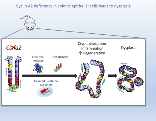 New study using DSS reveals cyclin A2 as a prognostic factor in colorectal cancer