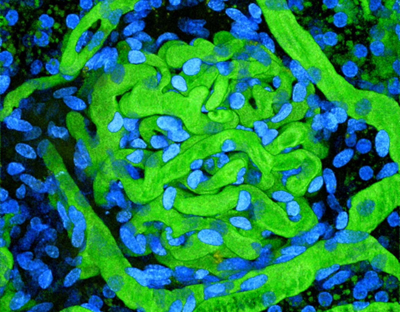 16th Sandoval 3877 3>