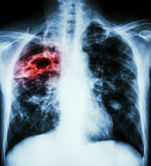 Application of FITC-Trehalose in Tuberculosis Diagnosis